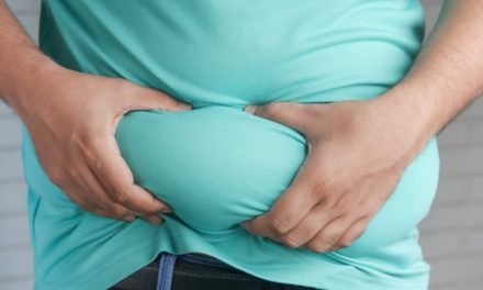 How Long Does It Take to Recover From Lap Band Surgery